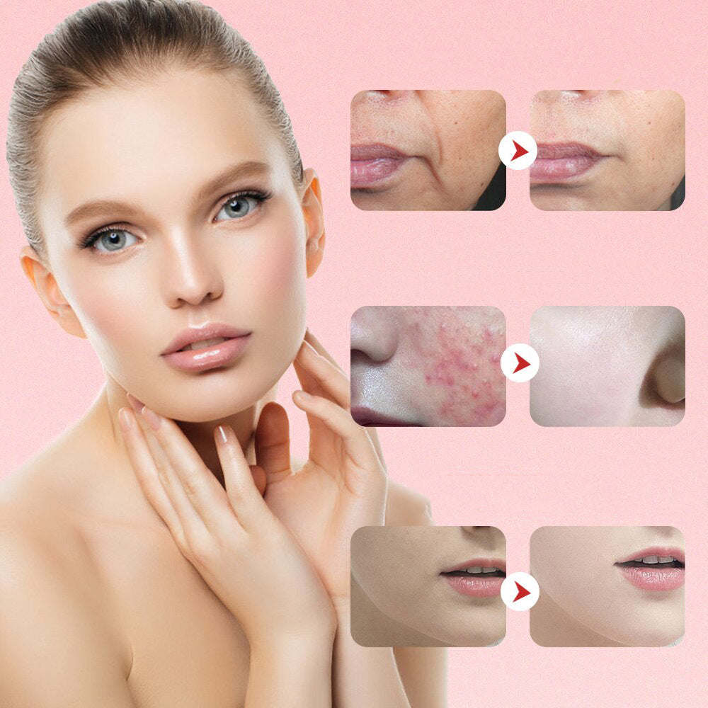 Anti-Aging Enhet – EMS & LED Ljusterapi för Ansiktslyft och Rynkreducering FyndOnline